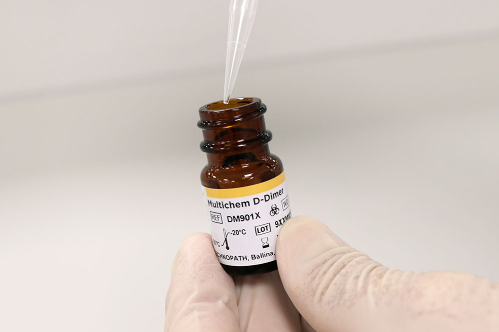 Multichem_DDimer_InHand Multichem D-Dimer