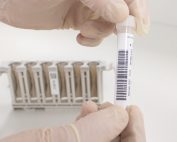 Multichem ID-SeroNeg Infectious Disease (ID) Quality Controls samples