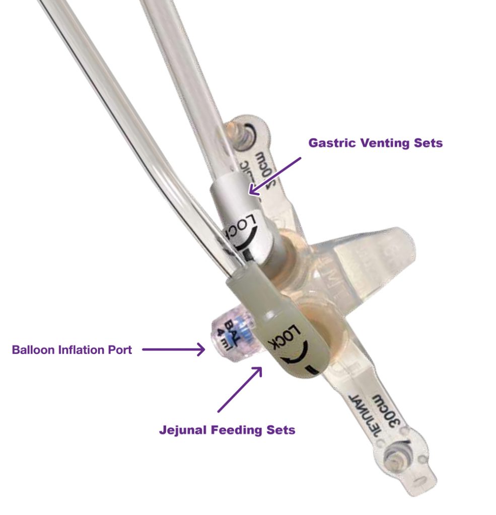 Low Profile GastroJejunal Enteral Tube TECHNOPATH