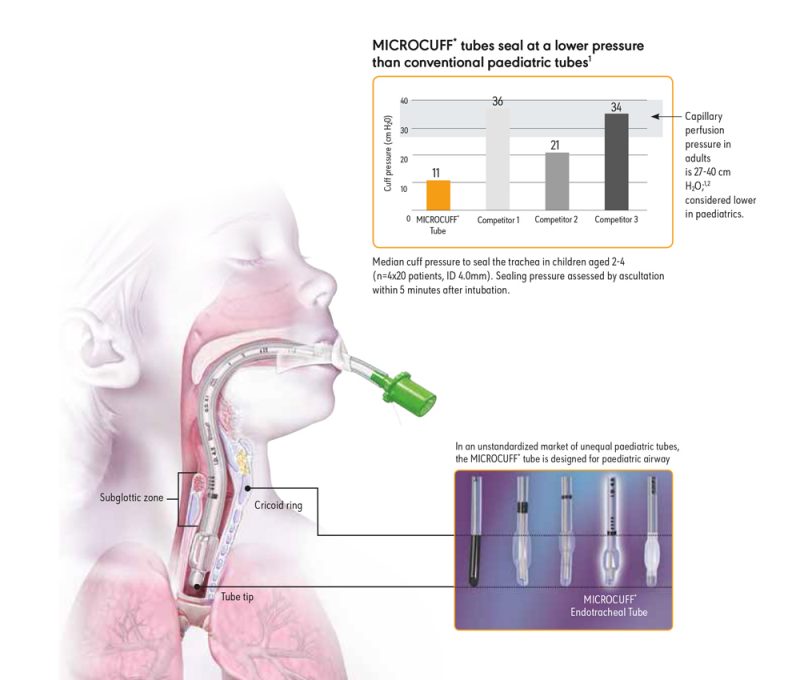Microcuff Od MICROCUFF* Paediatric Endotracheal Tubes - TECHNOPATH