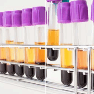 Diagast Immunohaematology QC