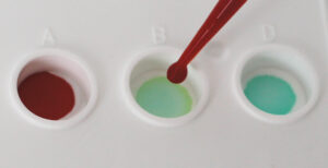 2-Depot-jpg 2. Blood dispensing