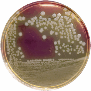 Clostridium difficile