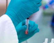 Immunohaematology Methods for Manual Techniques