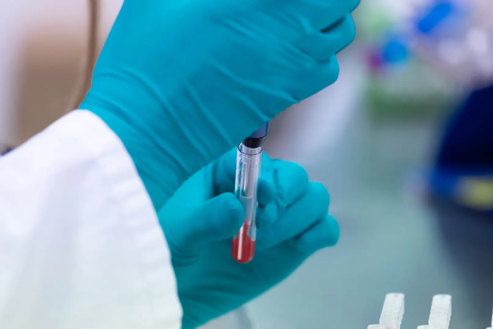 Immunohaematology Methods for Manual Techniques